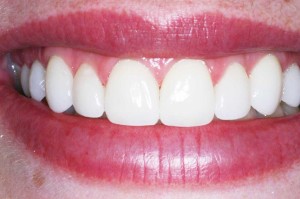 clinica dental sabadell
